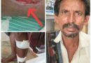 తుంగభద్ర నదిలో వ్యక్తి పై మొసలి మెరుపు దాడి..